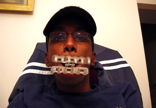 Myself, sitting in my dining room with a hair clip thing in my mouth.